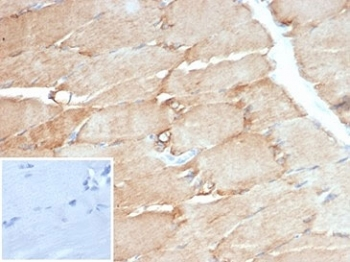 Desmin Antibody