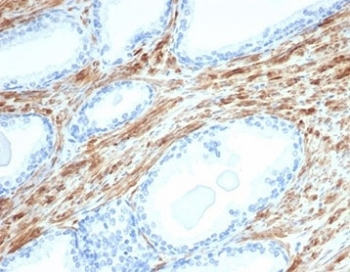 Desmin Antibody