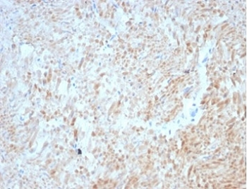 Desmin Antibody