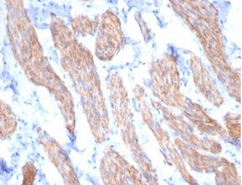 Desmin Antibody