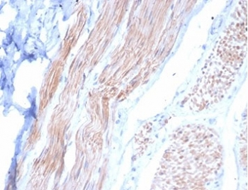 Desmin Antibody