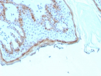 Recombinant FLG Antibody / Filaggrin