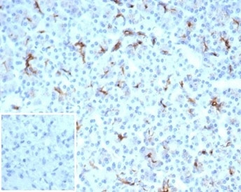 CFTR Antibody / Cystic Fibrosis Transmembrane Regulator