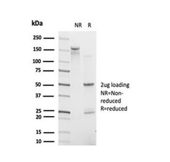 IRF9 Antibody / Interferon regulatory factor 9