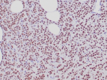Recombinant Estrogen Receptor alpha Antibody
