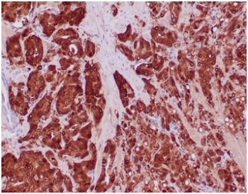 IDH1 Antibody / Isocitrate Dehydrogenase (R132H mutant)