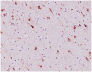 IDH1 Antibody / Isocitrate Dehydrogenase (R132H mutant)