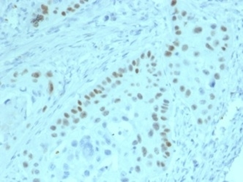 p63 Antibody / Tumor protein 63