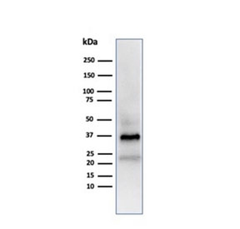 Clusterin Antibody / Apolipoprotein J / APO-J