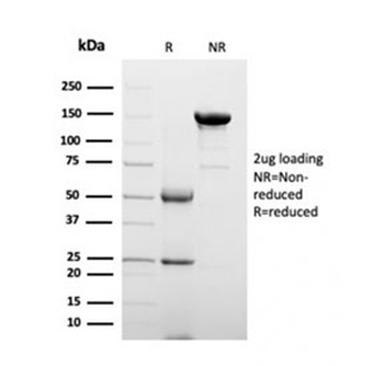 Clusterin Antibody / Apolipoprotein J / APO-J