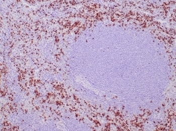 TIA-1 Antibody / T-Cell Intracellular Antigen-1