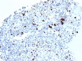 TIA-1 Antibody / T-Cell Intracellular Antigen-1