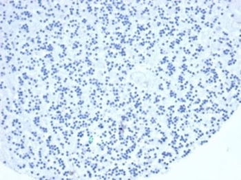 TIA-1 Antibody / T-Cell Intracellular Antigen-1