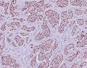 INSM1 Antibody