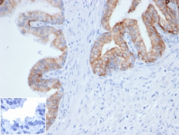 Recombinant Pan Cytokeratin Antibody Cocktail