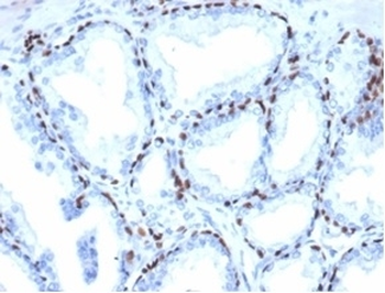 Recombinant deltaNp63 Antibody / p40