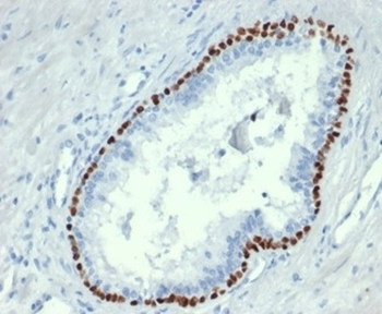 Recombinant p63 Antibody / Tumor protein 63