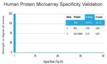 Recombinant p63 Antibody / Tumor protein 63