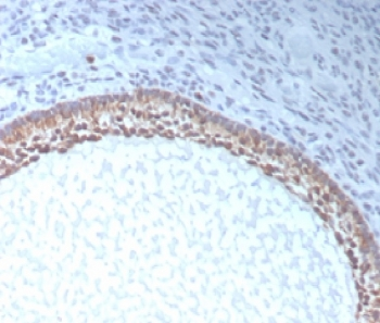 Muellerian Hormone Antibody / AMH / MIF
