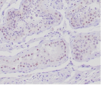 Muellerian Hormone Antibody / AMH / MIF