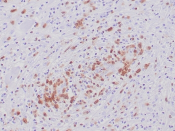 ALK Antibody / Anaplastic Lymphoma Kinase