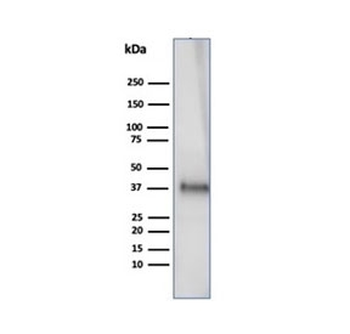 Clusterin Antibody / Apolipoprotein J / APO-J