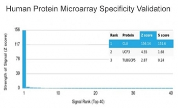 Clusterin Antibody / Apolipoprotein J / APO-J