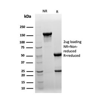 Clusterin Antibody / Apolipoprotein J / APO-J