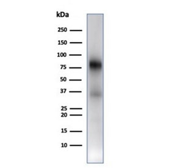 MPO Antibody / Myeloperoxidase