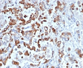 Recombinant Keratin 20 Antibody / CK20 / Cytokeratin 20
