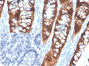 PDGF beta Antibody