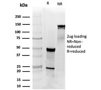 PDGF beta Antibody