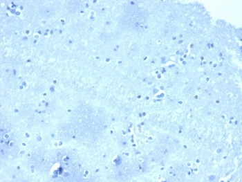 p120 Catenin Antibody / CTNND1 / Catenin delta 1