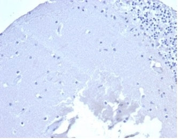Recombinant CD5 Antibody