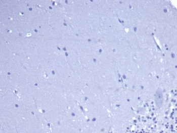 Recombinant CD5 Antibody
