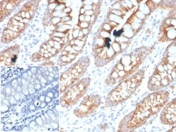 PDGF beta Antibody