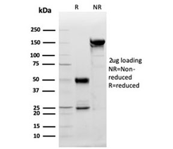 PDGF beta Antibody