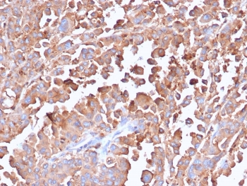 Recombinant Carcinoembryonic Antigen Antibody / CEA