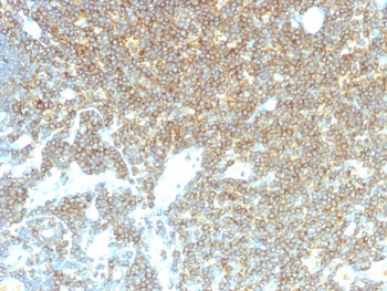 CD48 Antibody (Pan Leukocyte Marker)