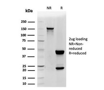 CD48 Antibody (Pan Leukocyte Marker)
