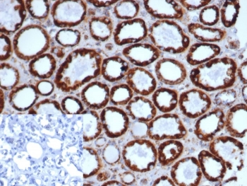 Recombinant HSPD1 Antibody / HSP60