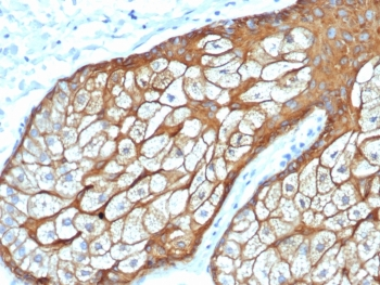 Basic Cytokeratin Antibody (HMW / Type II)