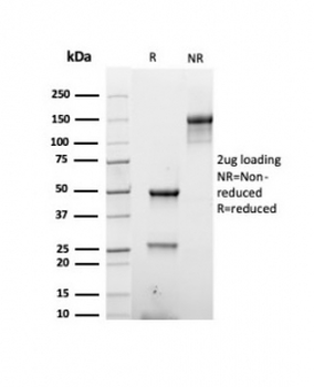 Basic Cytokeratin Antibody (HMW / Type II)