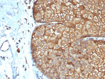 Acidic Cytokeratin Antibody (LMW / Type I)