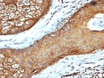 Acidic Cytokeratin Antibody (LMW / Type I)