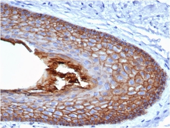 Cadherin 1 Antibody / CDH1 / E-Cadherin