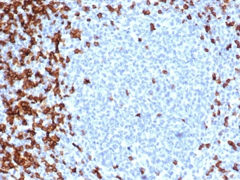 CD7 Antibody