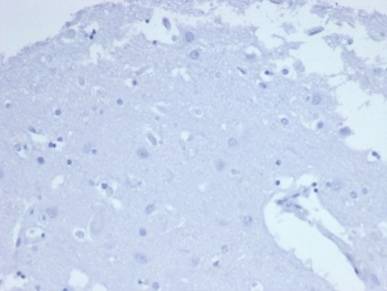 CD7 Antibody