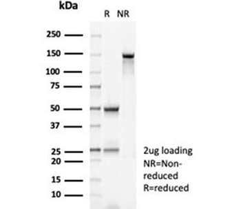 MSH2 Antibody