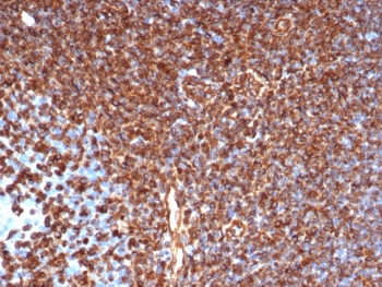 Recombinant VIM Antibody / Vimentin